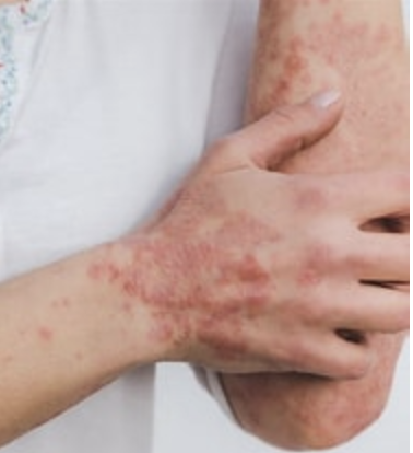 probleme peau probleme peau